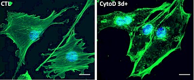 Immagine 2 - A Sinistra: le fibre di actina verde creano l'architettura della cellula. A destra: Aggiungendo la Citocalasina D le fibre di actina si sciolgono e si riformano  nei nuclei delle cellule. (Credit: UNC School of Medicine).