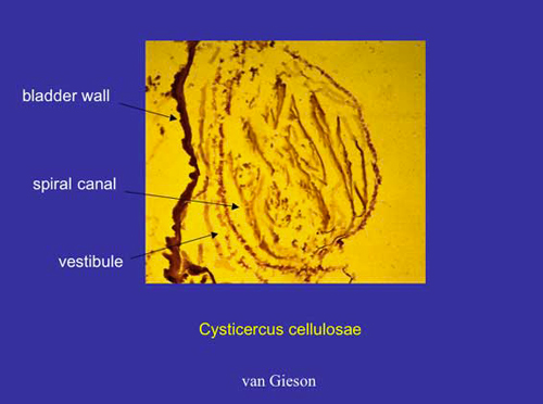 Immagine 3 - Cisticerco presente nello stomaco della mummia di Narni