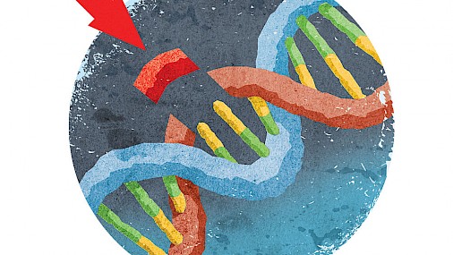 Trattare la leucemia con cellule immunitarie modificate geneticamente?