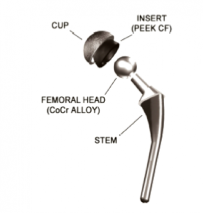 Schema protesi testa femorale lega CoCr