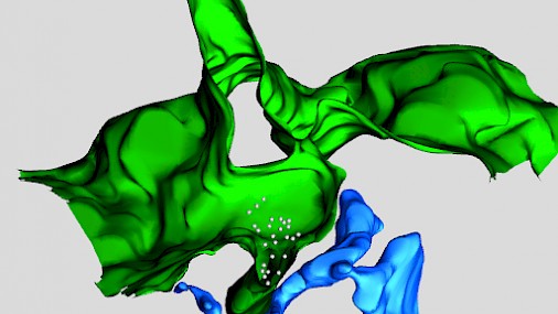 Ricerca italiana scopre come cellula “rottama” recettore implicato nei tumori