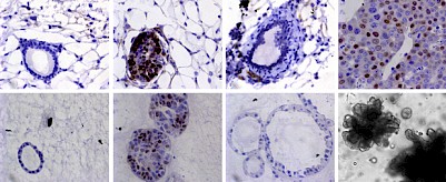 The team used mice (top) and organoids (bottom) in which they could induce tumours (2nd column), mimic perfect treatment and study minimal residual disease (3rd column), and analyse tumour recurrence (4th column). IMAGE: Jechlinger/EMBL