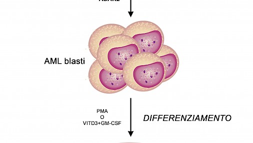 Identificati nuovi marcatori molecolari della leucemia mieloide acuta (LMA)