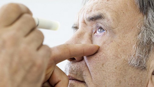 Scoperto link decisivo tra l'Alzheimer e le patologie agli occhi