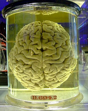 Immagine - cervello umano in contenitore trasparente - Credits: Gaetan Lee from London, UK, CC BY 2.0, via Wikimedia Commons