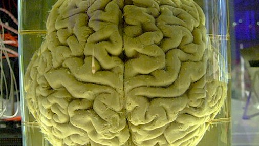 "Liberare" il cervello umano alterando gli stati di integrazione dinamica e segregazione