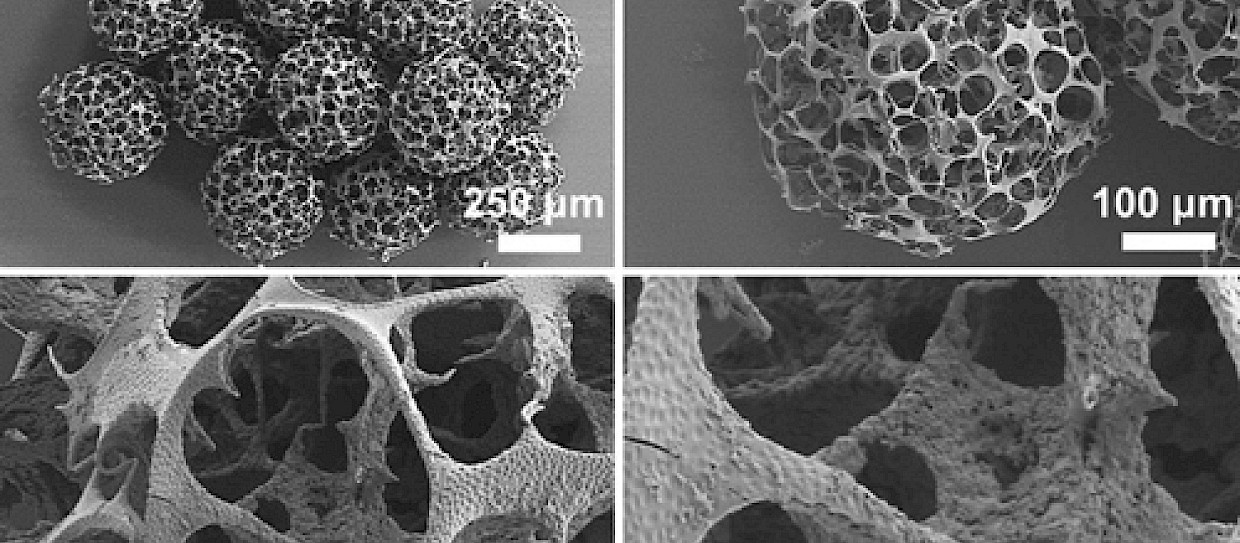 Microrobot iniettabili per riparare le lesioni al ginocchio?